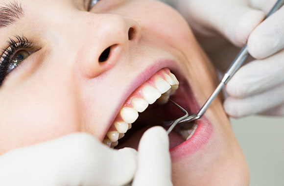 歯科衛生士による継続的なメンテナンス